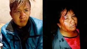 Elsa Fernández y su hijo Cristian, víctimas de la violencia policial en Chaco.