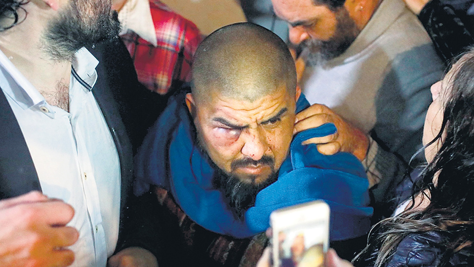 Diego Mendieta, pastor e integrante de la CTEP, recibió más de 40 trompadas en la cara.