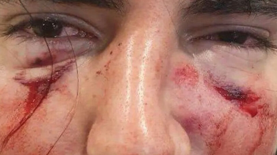 Un grupo de jugadores de rugby golpeó brutalmente a un joven …
