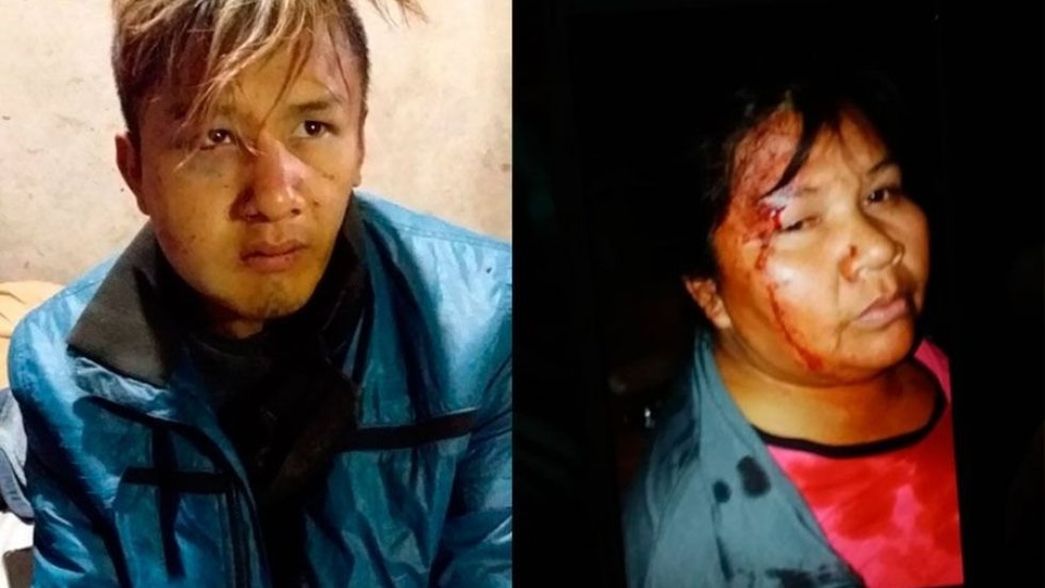 Elsa Fernández y su hijo Cristian, víctimas de la violencia policial en Chaco.