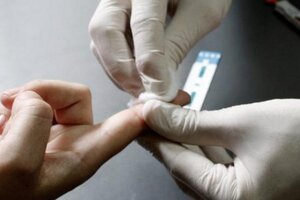 Ya no hace falta orden médica para hacer el test de VIH (Fuente: Télam)