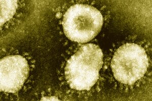 ¿Podría la variante sudafricana del coronavirus implicar un cambio en la vacuna? 