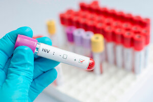 A 40 años de la aparición del VIH SIDA, la enfermedad está lejos de erradicarse