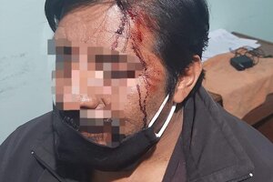 Violencia en Antofagasta