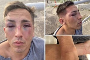 Mandarine Park: otra brutal golpiza de patovicas a un joven durante una fiesta