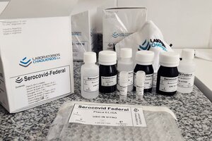 Científicos del Conicet desarrollaron un kit  para detectar anticuerpos de coronavirus