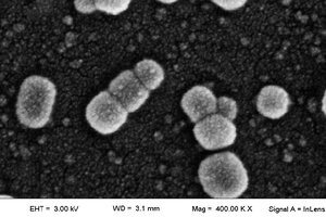 Imágenes de microscopía electrónica registradas durante la investigación del CONICET. Imagen: CONICET. 