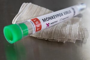 Un epidemiólogo chino aconsejó "no tocar extranjeros" para evitar contagiarse viruela del mono