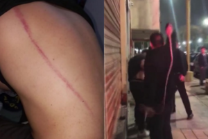 Violenta agresión en Tucumán: patovicas atacaron a latigazos a una pareja en un boliche