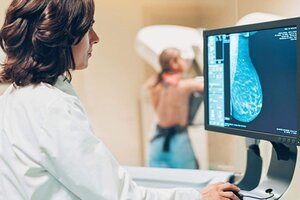 La Noche de las Mamografías: cómo será el despligue en los hospitales bonaerenses (Fuente: AFP)