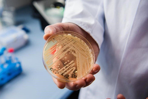 Qué se sabe de los dos primeros casos de Cándida auris