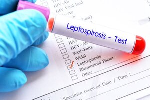 Leptospirosis: qué es y cómo prevenir la enfermedad 