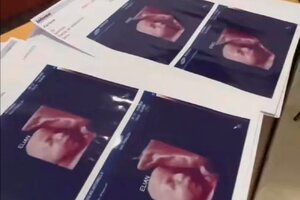 El extraño caso de la clínica de ecografías que entregaba la misma foto a todas las embarazadas