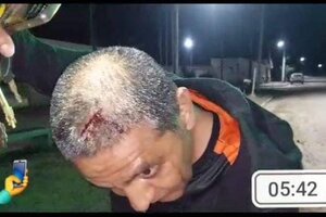 Atacaron con un machete a periodista de Pichanal 