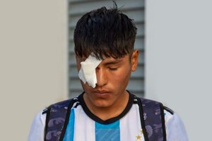 Testimonios de la violencia policial en Jujuy: "Me dí vuelta y me dispararon en la cara"