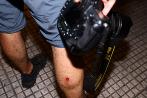 Habló el periodista de Télam baleado por la policía: "Quedamos atrapados en una cacería" (Fuente: Télam)