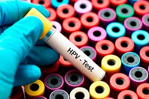 Día mundial del HPV, un virus cancerígeno muy común y poco conocido