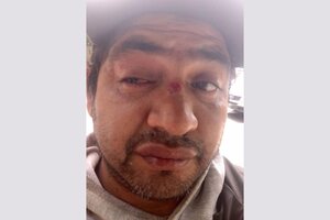 Un manifestante perdió la visión de un ojo por la represión policial