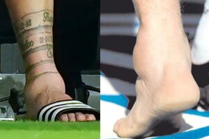 La lesión de Messi: cómo le quedó el tobillo y la impactante comparación con Maradona