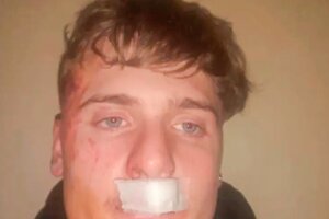 Un grupo de rugbiers de Zárate golpeó brutalmente a un joven de 19 años