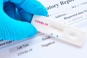 ¿PCR o antígenos? Todo lo que hay que saber sobre los test de coronavirus