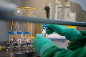 Coronavirus: denuncian que los kits para testear al personal de los hospitales públicos “dan falsos positivos y falsos negativos”
