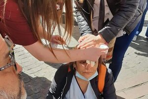 Enfermera de la Ciudad de Buenos Aires: "Un policía me golpeó primero en la boca del estómago y al agacharme me pegó un palazo en la cabeza”