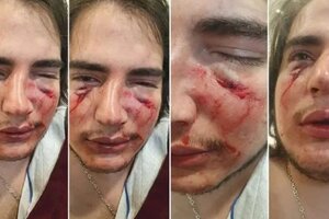 Córdoba: cuatro rugbiers golpearon brutalmente a un joven de 18 años