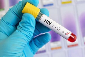 El ajuste a los pacientes de VIH llegó a los controles de transmisión