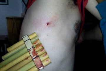 Uno de los músicos heridos, con su sikus ensangrentado. (Fuente: Facebook)
