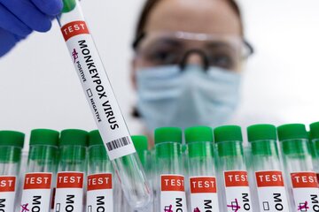 Viruela del mono: autorizan el uso de la vacuna Imvanex (Fuente: AFP)