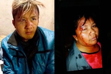 Elsa Fernández y su hijo Cristian, víctimas de la violencia policial en Chaco.