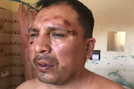 Así quedó Rodríguez tras la irrupción policial en su hogar. 