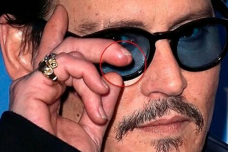 El médico de Johnny Depp dice que encontró el dedo del actor en la escena de una pelea