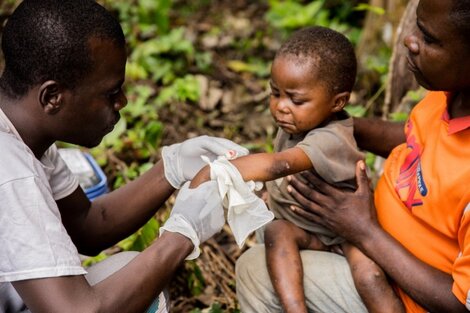 Un niño de República Centroafricana contagiado por la viruela del mono es atendido por un agente sanitario.