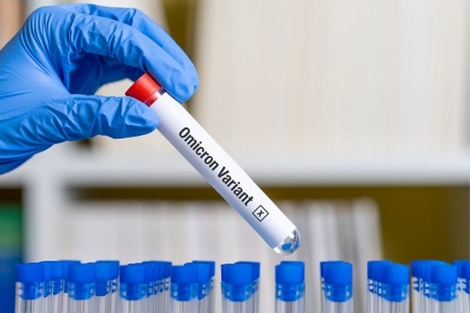 Las nuevas variantes del coronavirus cambiaron los síntomas predominantes del covid-19. (Foto: Pixabay)