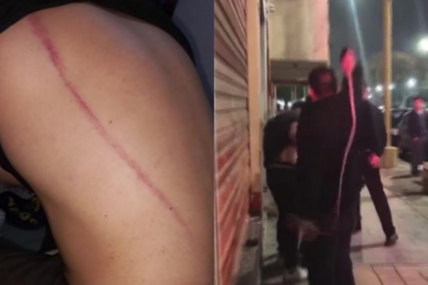 Violenta agresión en Tucumán: patovicas atacaron a latigazos a una pareja en un boliche