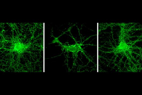 Importante avance científico argentino para combatir el Alzheimer.