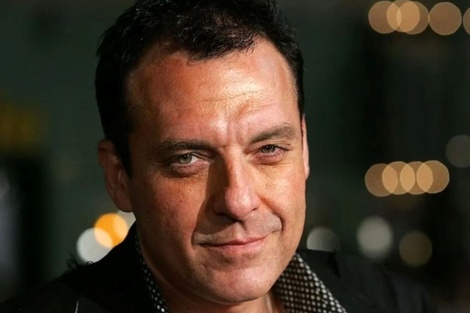 Qué es un aneurisma, el accidente cerebral que dejó a Tom Sizemore en estado de coma