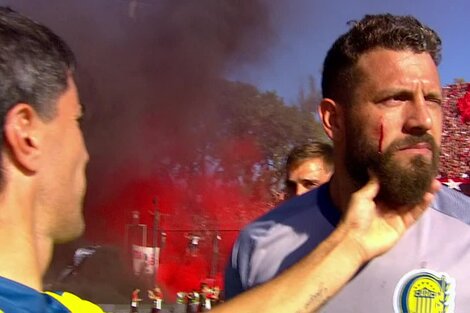 El clasico Newell's - Rosario Central, con los mismos problemas de siempre