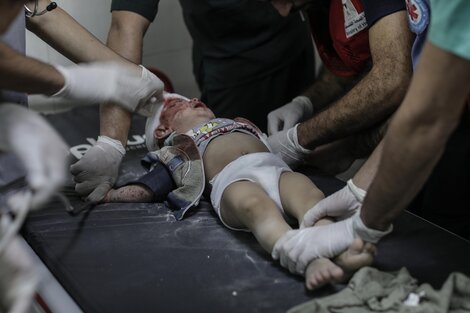 Un niño recibe atención hospitalaria en el  Hospital Nasser de Khan Yunis, Gaza.