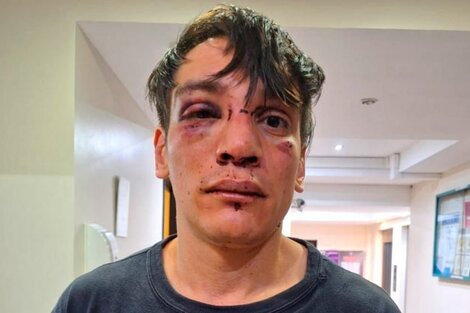 "¿Venís de la marcha?": brutal ataque de la Policía de la Ciudad a un abogado tras la protesta universitaria