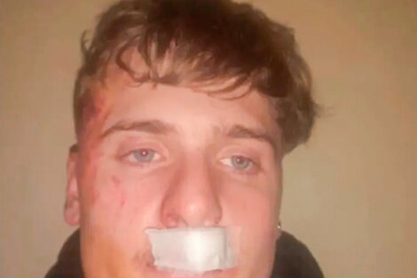 Un grupo de rugbiers de Zárate golpeó brutalmente a un joven de 19 años