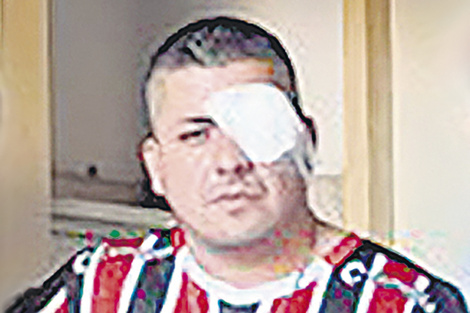 Tapa del suplemento