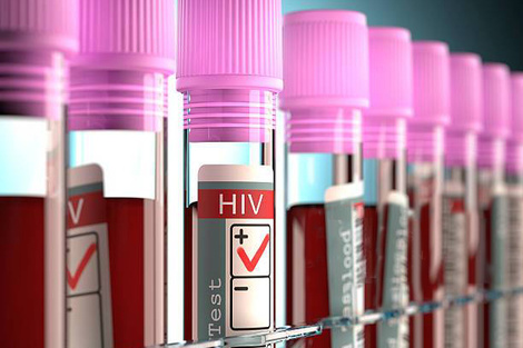 Denuncian falta de reactivos para detectar casos de VIH