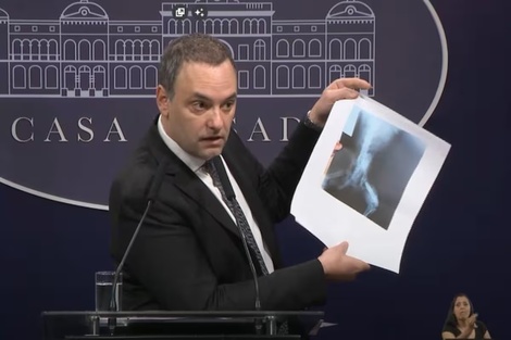 Manuel Adorni: veedor y propagador de fakes news