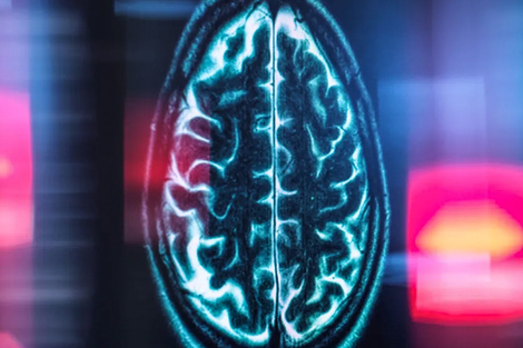 La ciencia busca frenar al Alzheimer.