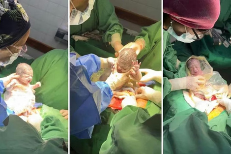Las trigemelas Ainara, Amira y Ámbar nacieron en el Hospital Público Materno Infantil de Salta