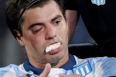 La imagen de cómo quedó Sosa es por demás elocuente