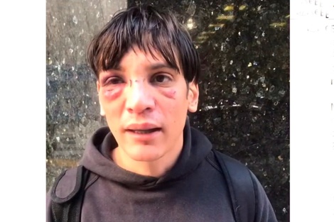 El abogado Matias Darabos de la Asociación contra la Violencia Institucional fue golpeado por agentes policiales